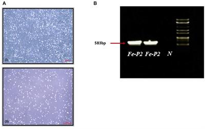 Genetic Characterization of Feline Parvovirus Isolate Fe–P2 in Korean Cat and Serological Evidence on Its Infection in Wild Leopard Cat and Asian Badger